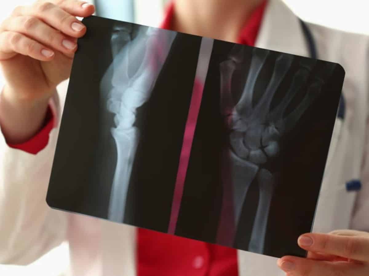 A doctor holding up an x-ray.